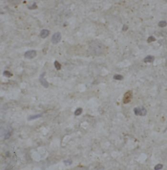 SNU13 Rabbit Polyclonal Antibody