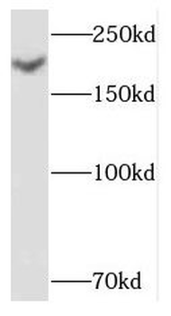 NID2 Rabbit Polyclonal Antibody