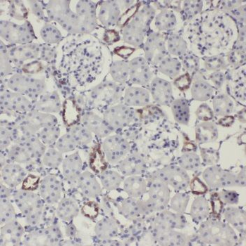 NID2 Rabbit Polyclonal Antibody