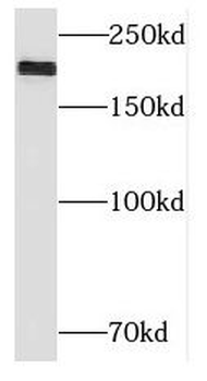 NID2 Rabbit Polyclonal Antibody
