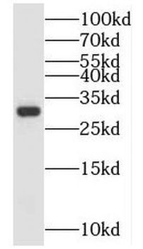 NIT2 Rabbit Polyclonal Antibody