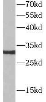 KLRC1 Antibody