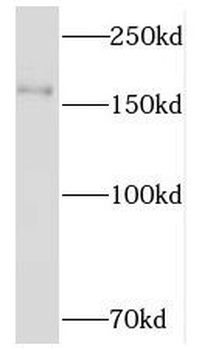 NKTR Rabbit Polyclonal Antibody