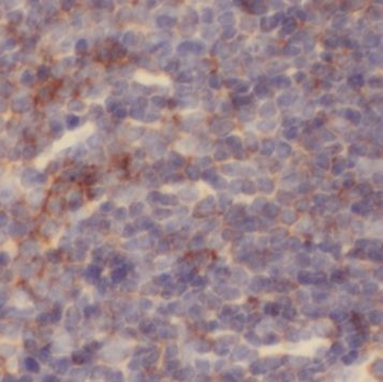 NKTR Rabbit Polyclonal Antibody
