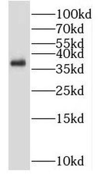 NKX2 5 Rabbit Polyclonal Antibody
