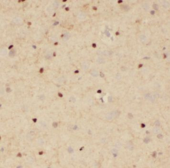 NKX2 5 Rabbit Polyclonal Antibody
