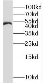 NLE1 Rabbit Polyclonal Antibody