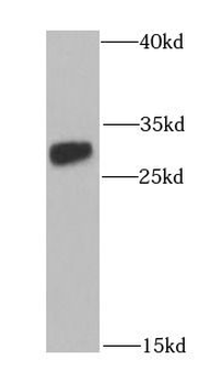 NNMT Rabbit Polyclonal Antibody