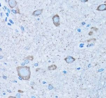 NNMT Rabbit Polyclonal Antibody