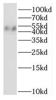 NOB1 Rabbit Polyclonal Antibody