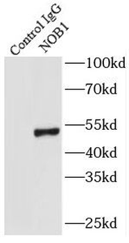 NOB1 Rabbit Polyclonal Antibody