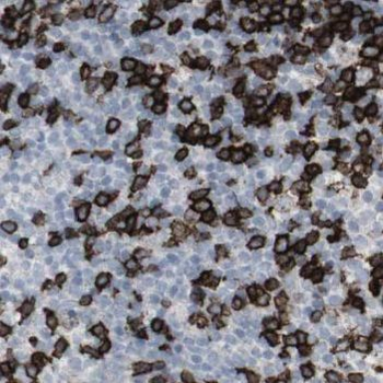 NOB1 Rabbit Polyclonal Antibody