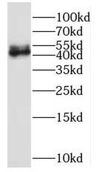 NOB1 Rabbit Polyclonal Antibody