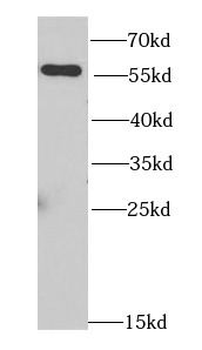NONO Rabbit Polyclonal Antibody