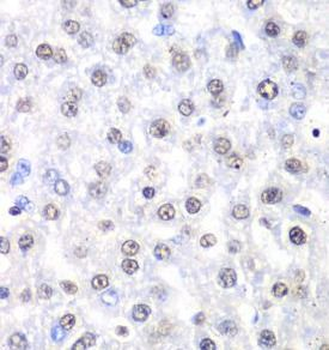 NONO Rabbit Polyclonal Antibody
