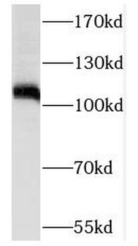 NOP2 Rabbit Polyclonal Antibody