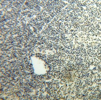 NOP2 Rabbit Polyclonal Antibody