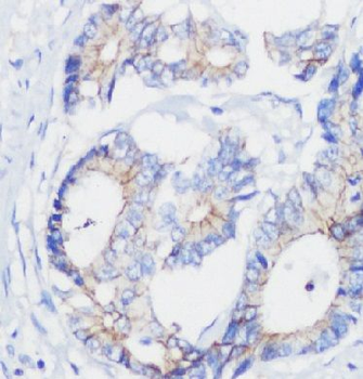 NOX1 Rabbit Polyclonal Antibody