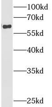 CYBB Rabbit Polyclonal Antibody
