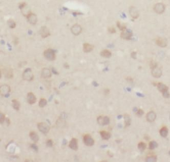 CYBB Rabbit Polyclonal Antibody