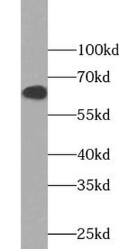 NOX5 Rabbit Polyclonal Antibody