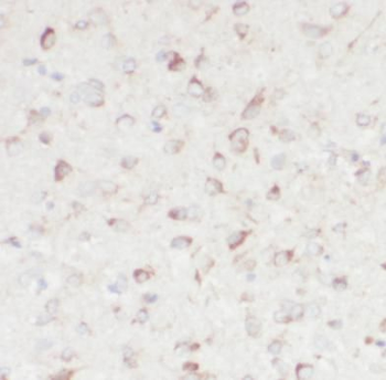 NPC1 Antibody