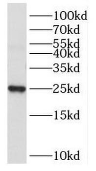 NPM3 Rabbit Polyclonal Antibody