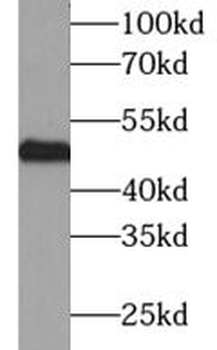 NPTX1 Rabbit Polyclonal Antibody