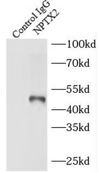 NPTX2 Antibody