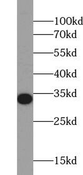 NQO1 Antibody