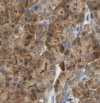 NQO1 Antibody