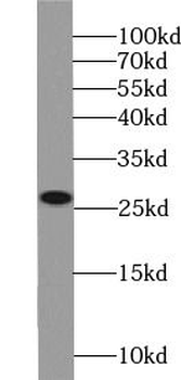 NQO2 Rabbit Polyclonal Antibody