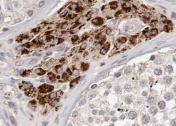 NQO2 Rabbit Polyclonal Antibody