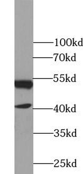 NR1H2 Rabbit Polyclonal Antibody