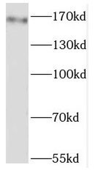 GRIN2B Rabbit Polyclonal Antibody