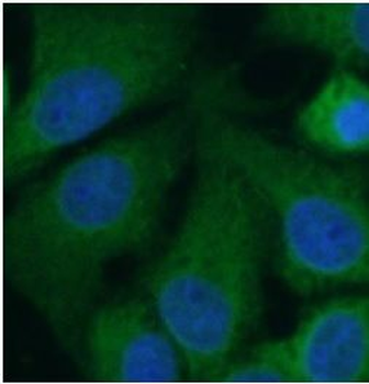 GRIN2B Rabbit Polyclonal Antibody