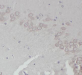 GRIN2B Rabbit Polyclonal Antibody