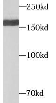 GRIN2B Rabbit Polyclonal Antibody