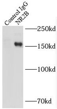 GRIN2B Rabbit Polyclonal Antibody