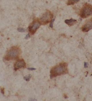 GRIN2B Rabbit Polyclonal Antibody