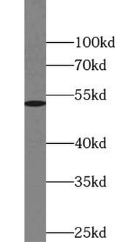 NR5A1 Antibody