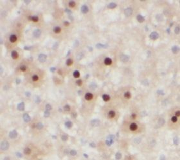 NR5A1 Antibody
