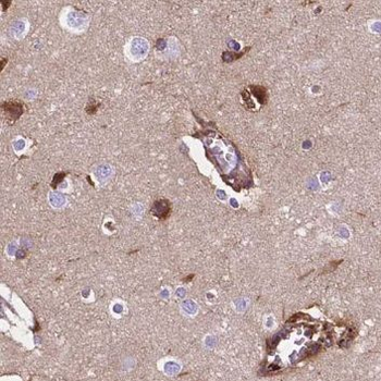 NRCAM Rabbit Polyclonal Antibody