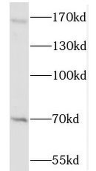 NSD3 Rabbit Polyclonal Antibody