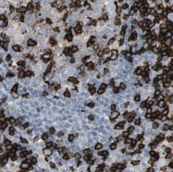 NSD3 Rabbit Polyclonal Antibody