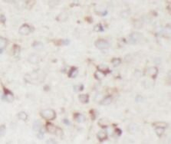 ENO2 Antibody