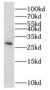 NSMCE2 Rabbit Polyclonal Antibody
