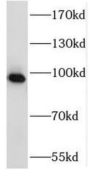 NSUN2 Rabbit Polyclonal Antibody