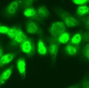 NSUN2 Rabbit Polyclonal Antibody