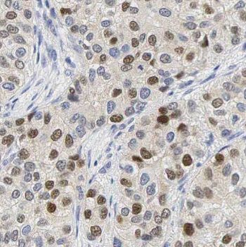 NSUN2 Rabbit Polyclonal Antibody